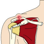 ac-leds-artros-300x300